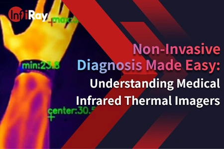 Простота неинвазивной диагностики: понимание медицинских инфракрасных тепловизоров