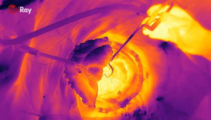 04_thermal_imaging_camera_used_in_medical.png